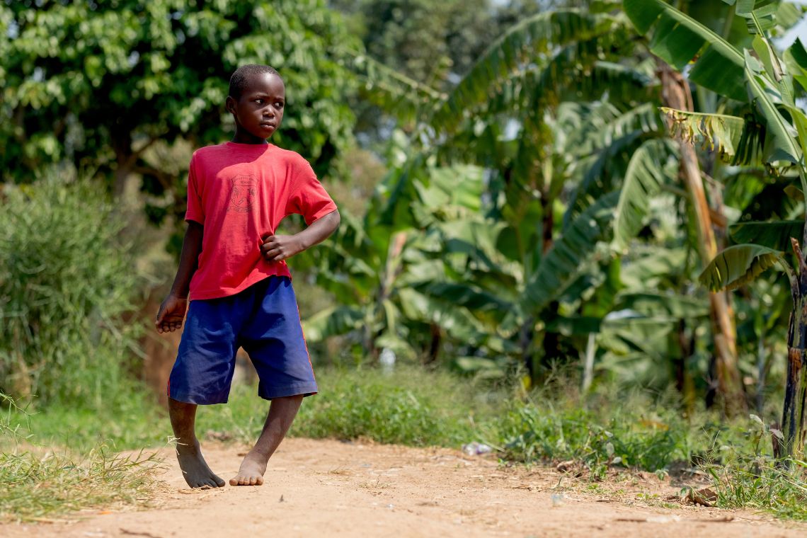 Stuart (8) aus Uganda leidet an O-Beinen